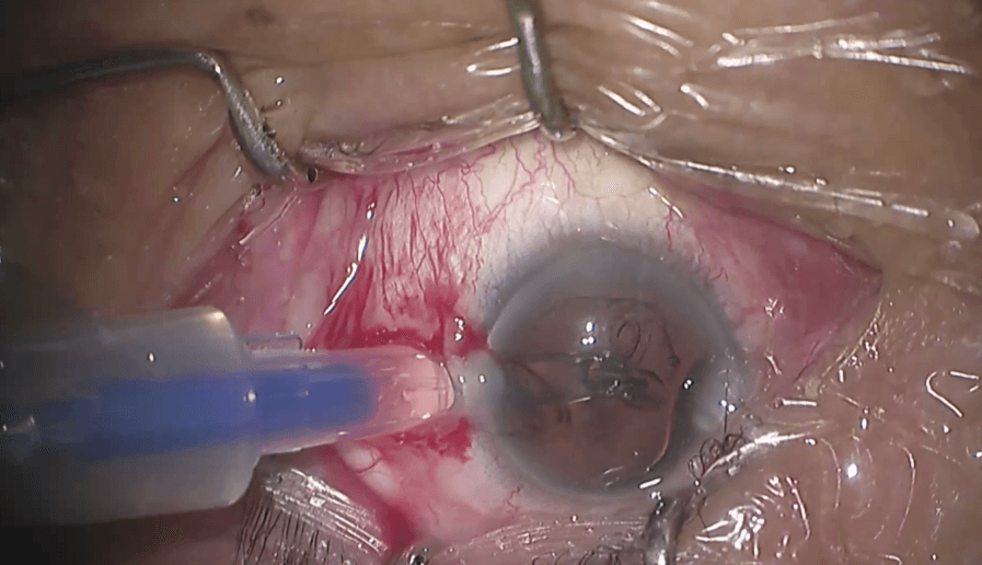 Intensity Eilat 2020 Session 17-03-2020